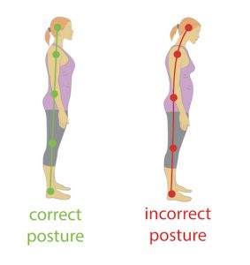 This is an image of correct and incorrect posture due to weka postural muscles.  Flat feet can cause your low back pain by weakening your postural muscles.