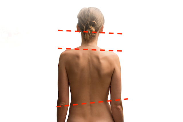 About Posture Alignment Therapy - Align Your Body