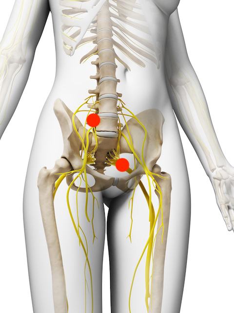This is a picture of the spine and the sciatic nerve that can get pinched causing sciatica pain.