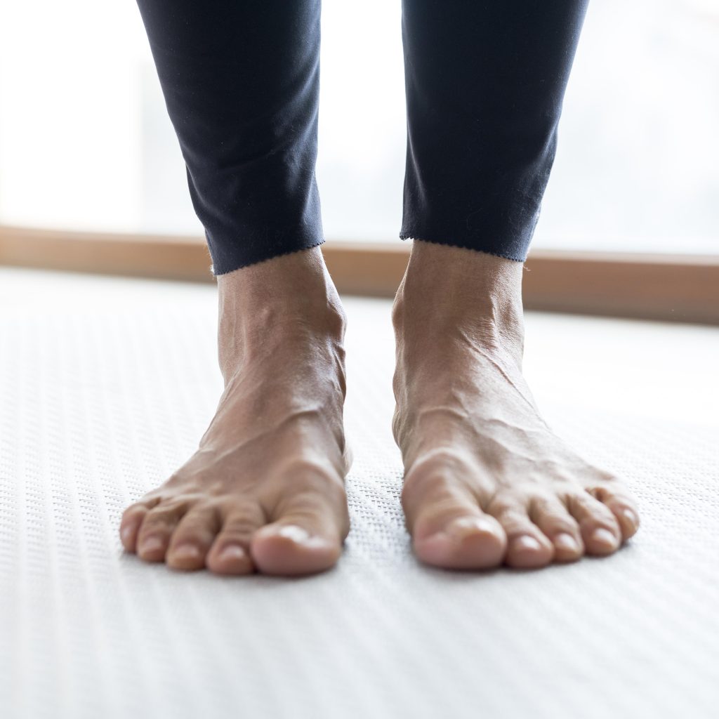 This is a picture of a person with flat feet. Discover how you can get thorough flat feet treatment in Edmonton from Dr. Dean Collins.